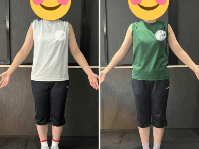 Before after minimal skincare Instagram post-3